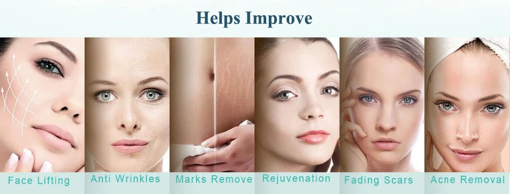 0.2/0.25/0.3mm 540 Derma Roller Micro Needle For Facial Skin Body Face Care