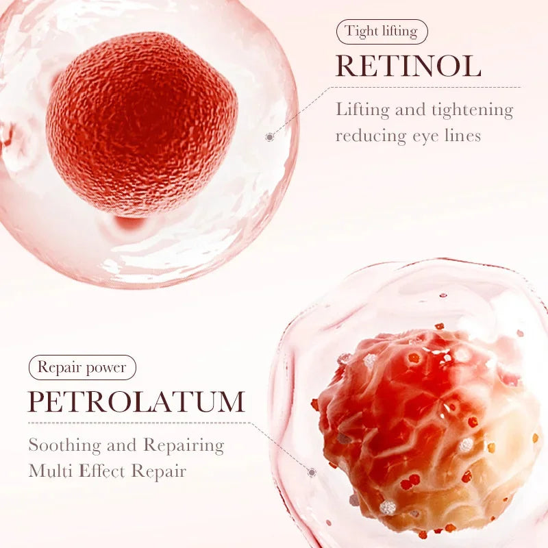 Retinol Eye Cream Remove Dark Circles Woman Eye Care