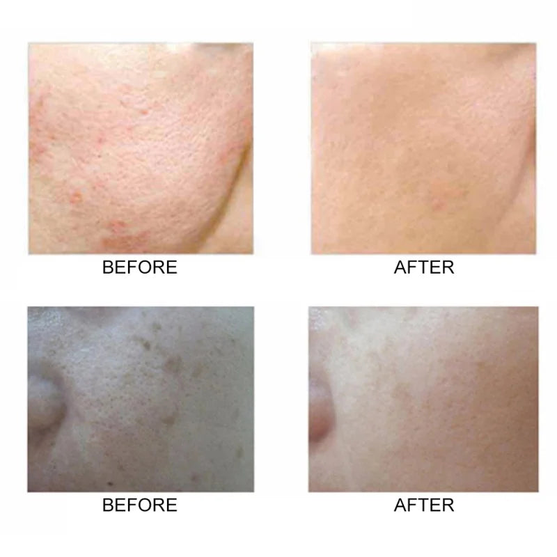 3D Bilateral Silicone Facial Cleanser Manual Massage Face Brush Cleaning Tools