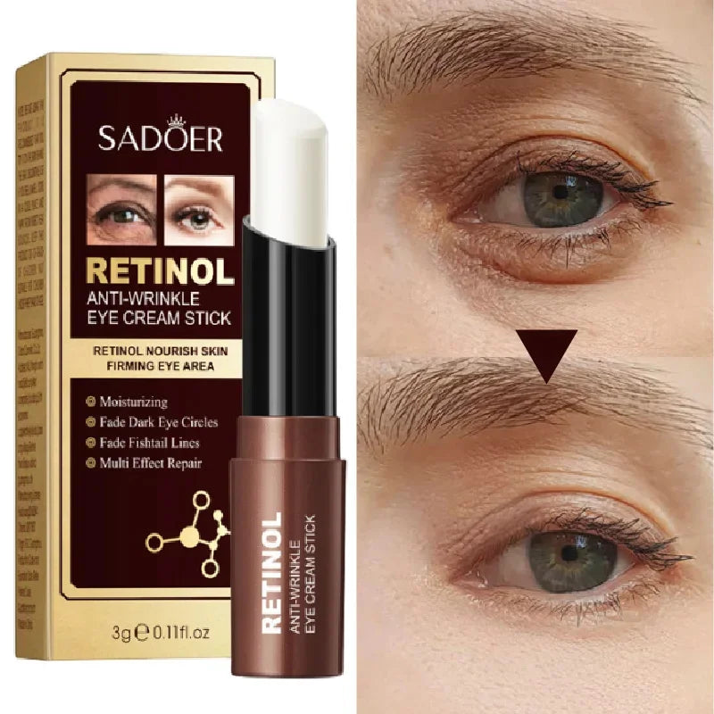 Retinol Eye Cream Remove Dark Circles Woman Eye Care